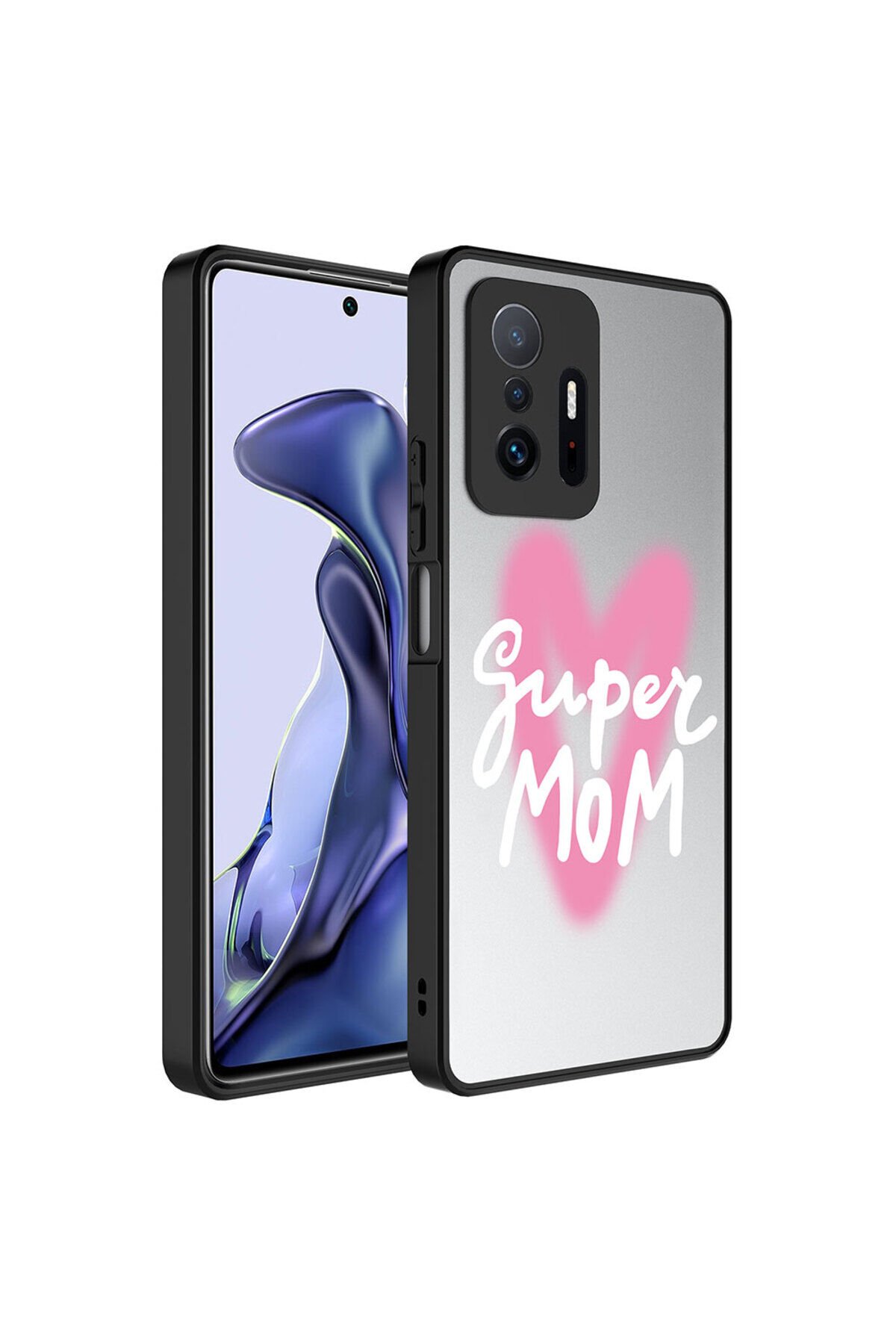 Mi 11T 5G Kılıf Aynalı Desenli Kamera Korumalı Parlak ASMA Mirror Kapak - Süper Anne Süper Anne