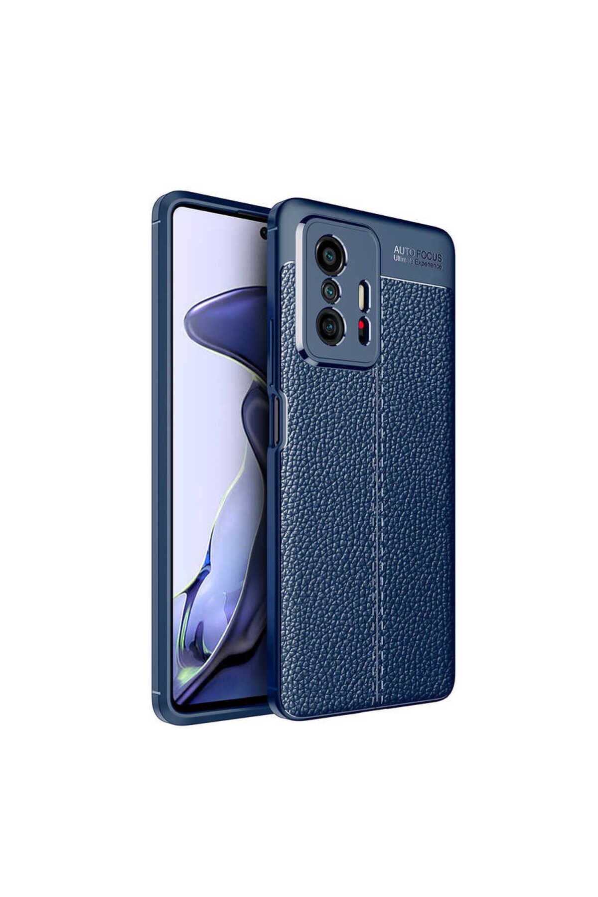 Mi 11T 5G Kılıf BSAY Niss Silikon Kapak - Lacivert