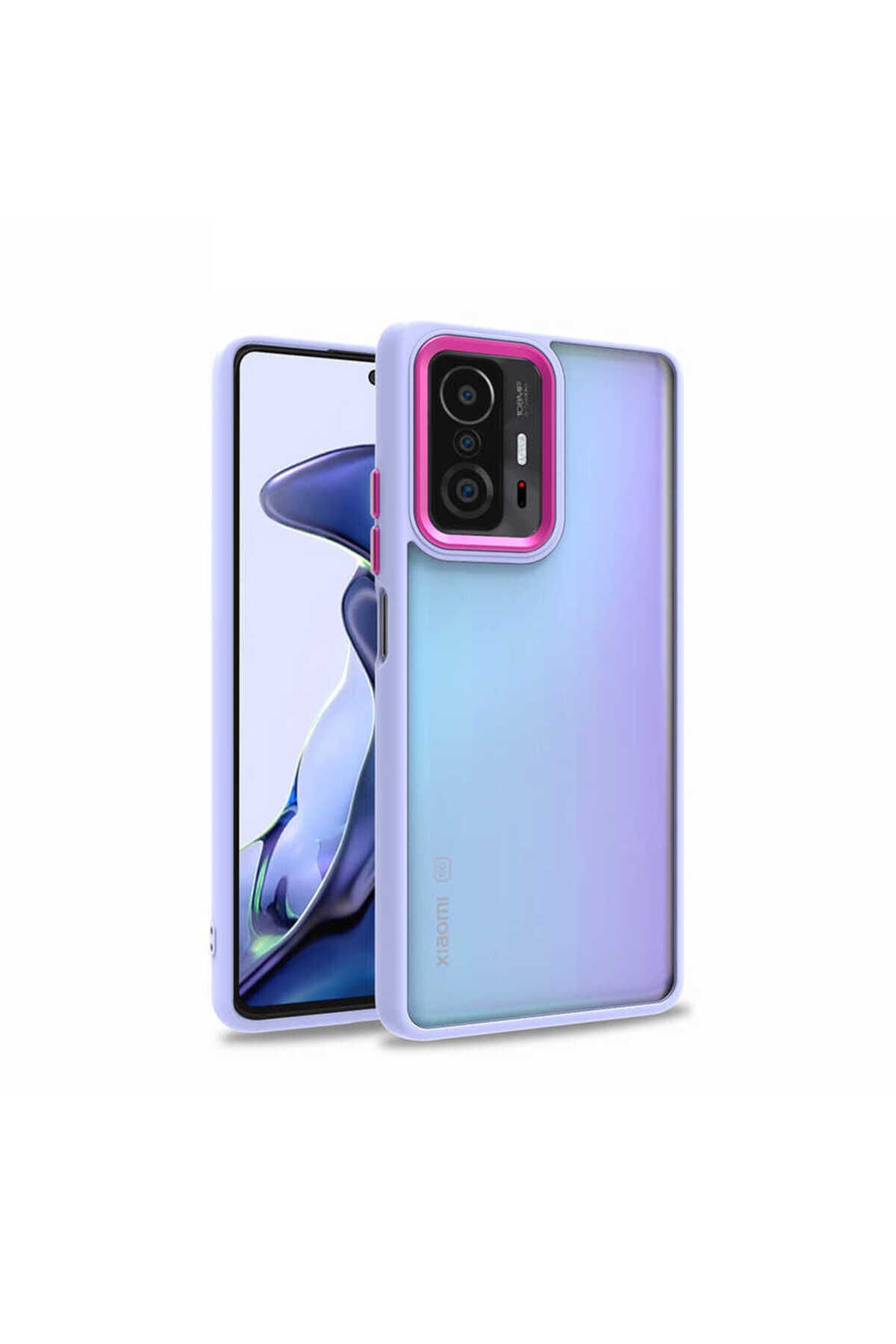 Mi 11T 5G Kılıf ASMA Flora Kapak - Lila Lila