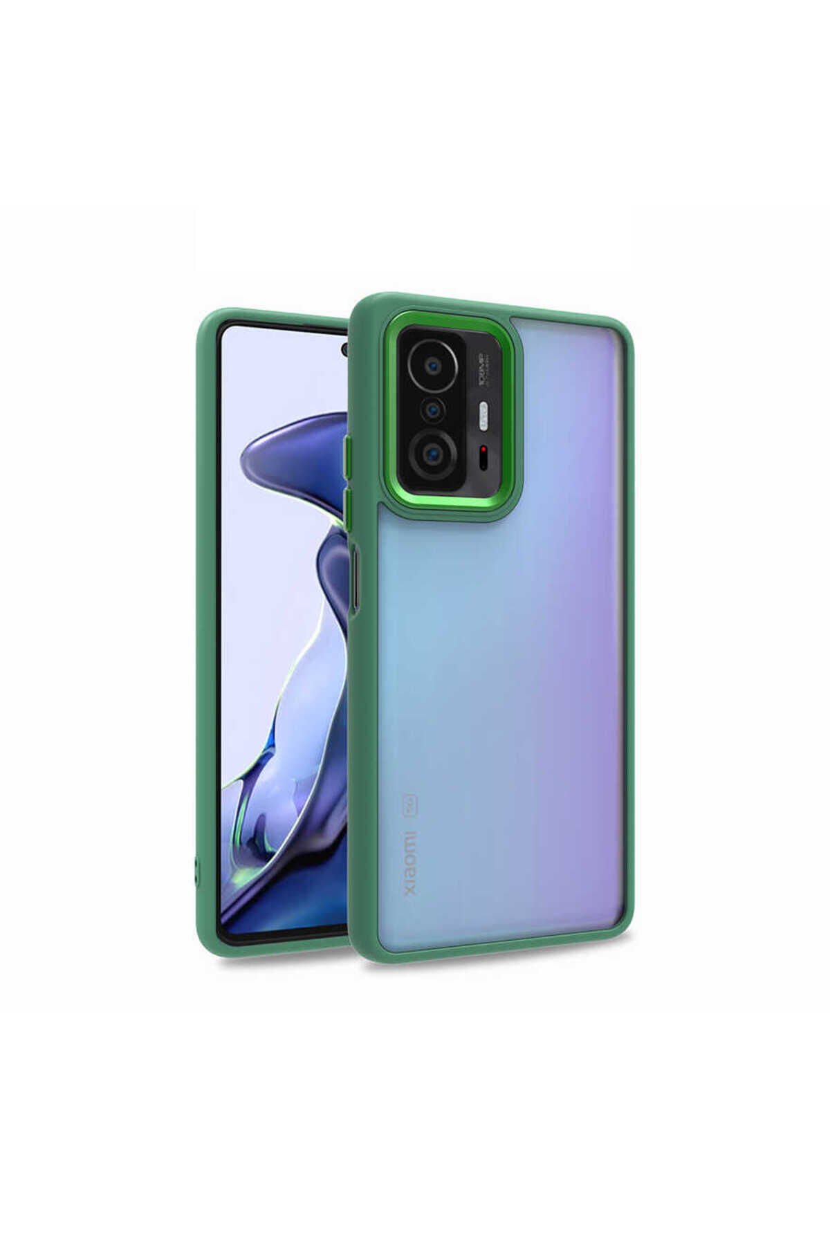 Mi 11T Pro 5G Kılıf ASMA Flora Kapak - Lila Lila