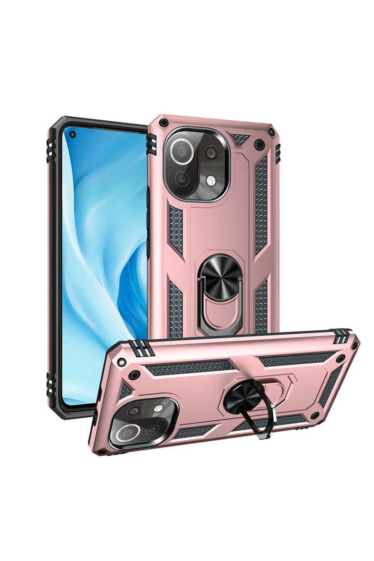 Mi 11 Lite Kılıf BSAY Vega Kapak - Gri Rose Gold