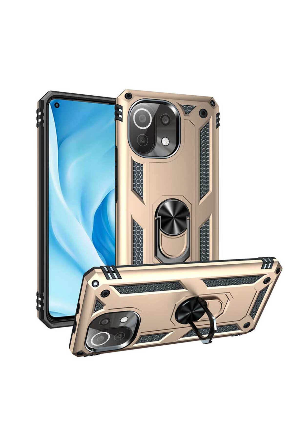 Mi 11 Lite Kılıf BSAY Vega Kapak - Gri Gold