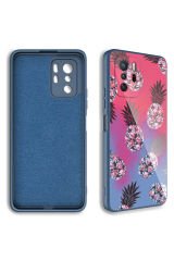 Redmi Note 10 Pro Kılıf Kamera Korumalı Desenli Sert Silikon BSAY Epoksi Kapak - NO3 No3
