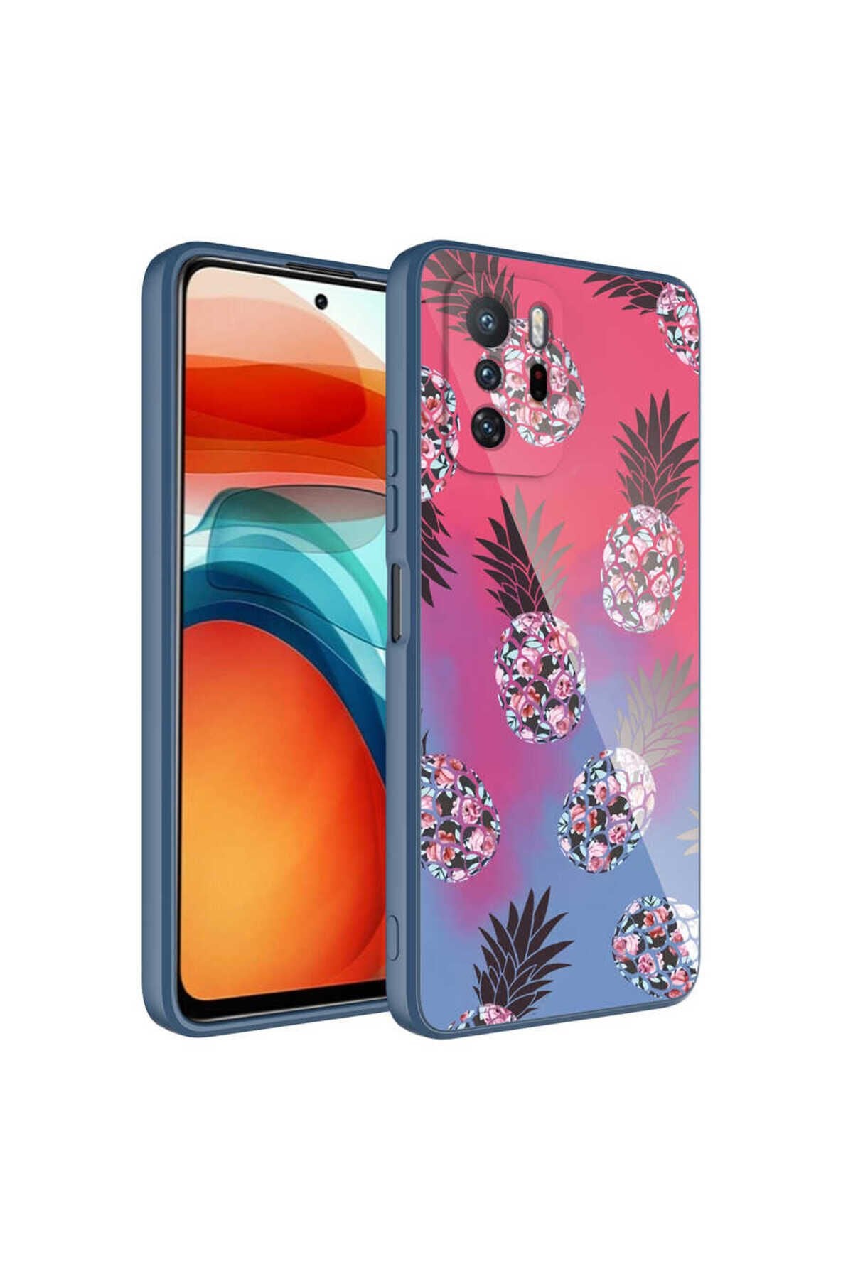 Redmi Note 10 Pro Kılıf Kamera Korumalı Desenli Sert Silikon BSAY Epoksi Kapak - NO3 No3