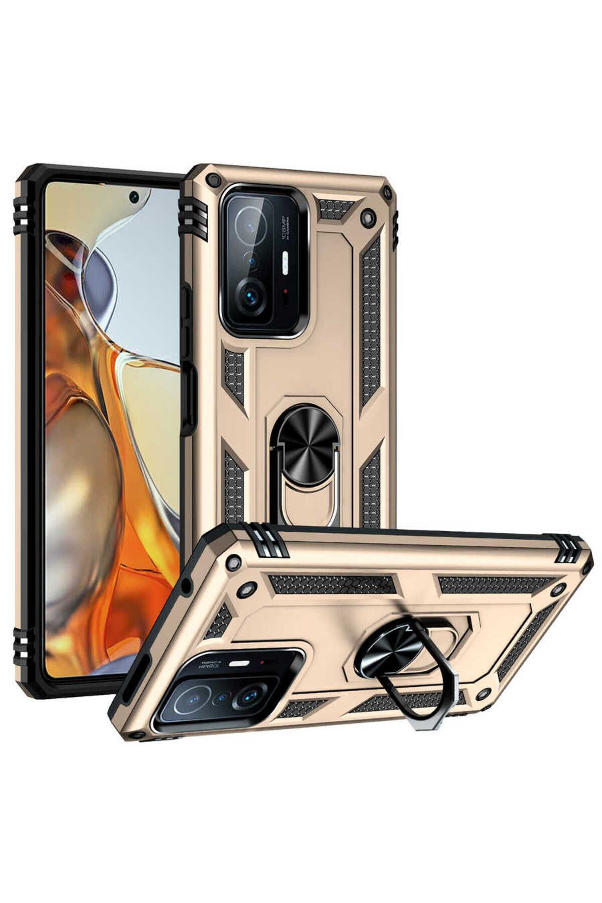 Mi 11T 5G Kılıf ATA Vega Kapak - Gold Gold